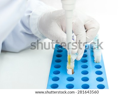 Hand open sample cap tube and pipetting, Laboratory working