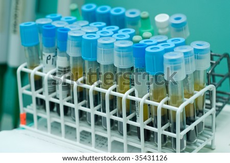 test tubes in white rack