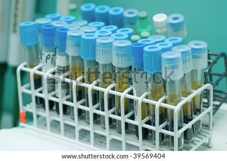 close up of test tubes in white rack