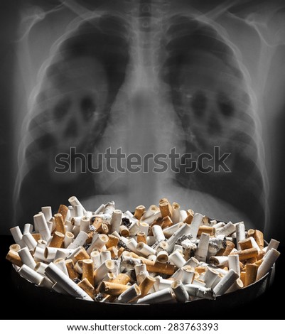 Cigarette smoke damages lungs - stop smoking!\
Ashtray full of cigarette ends with lungs background