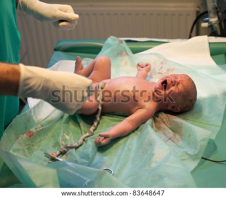 newborn baby being examined in delivery room by doctor