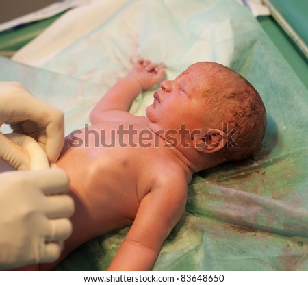 newborn baby being examined in delivery room by doctor