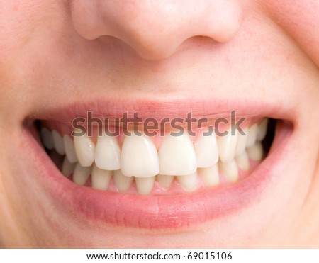 young woman with a teeth broken and rotten