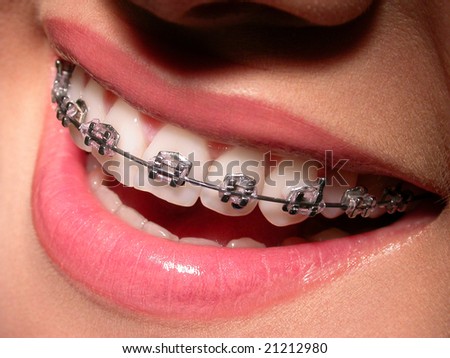Pictures Of Lips And Teeth. stock photo : Smiling lips