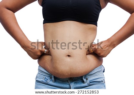 Women body with fat belly and stretch marks,front view