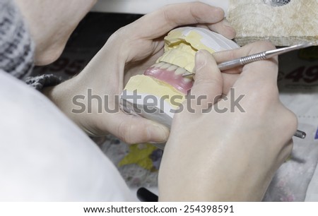 A dentist / dental technician working the partial denture