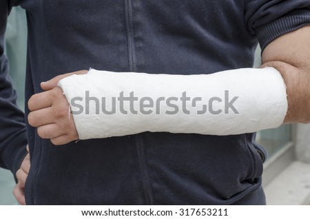 Man with his broken arm. Arm in cast, face not visible.