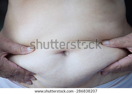 Older woman with fat belly and hand withered