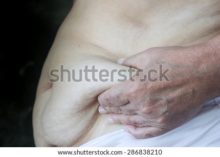 Older woman with fat belly and hand withered