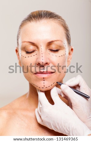 doctor draw correction line on a patient before cosmetic surgery