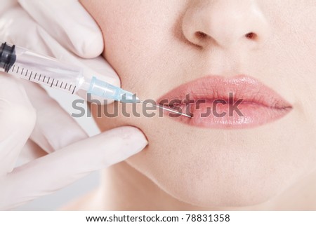 woman receiving an injection in her lip