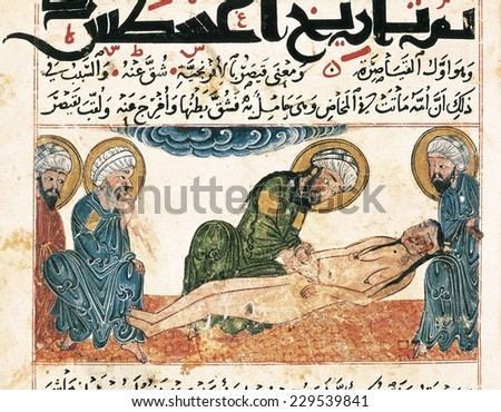 Al-Biruni Manuscript, Folio 161, 16r with a cesarean illustration, Islamic art, Miniature Painting, SCOTLAND