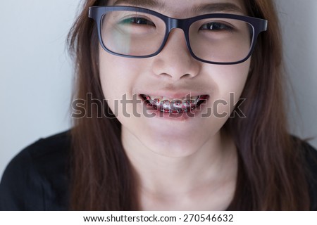 Close up  Young asian girl smiling and glasses in black shirt
