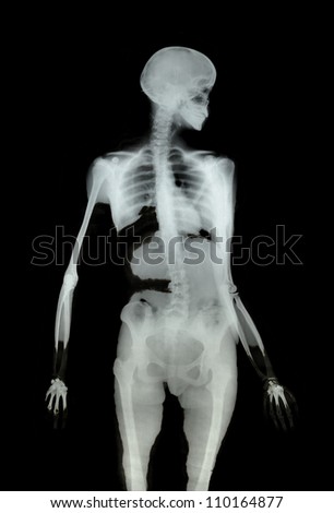 A body medical x-ray scan  on a black background.