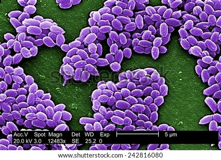 Spores from an anthrax bacteria. These spores live for many years enabling the bacteria to survive in a dormant state. Photo by Janice Haney Carr, 2002.