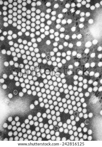 Electron micrograph of the poliovirus. 1975.
