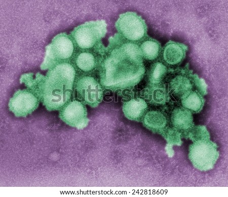 This colorized negative stained transmission electron micrograph of the A/CA/4/09 swine flu virus. 2009 photo by C. S. Goldsmith and A. Balish.