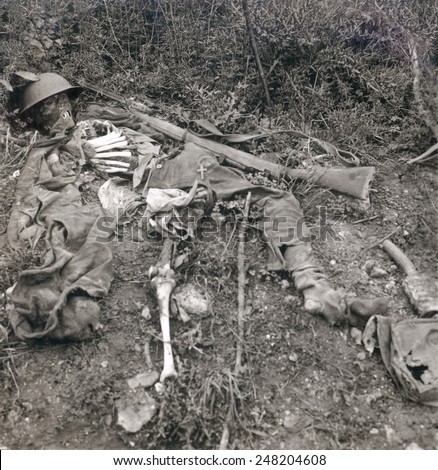 World War 1. Human wreckage in No Man\'s Land, Chemin des Dames, France. The remains of a British soldier on the battlefield during World War I. Ca. 1914-1915.