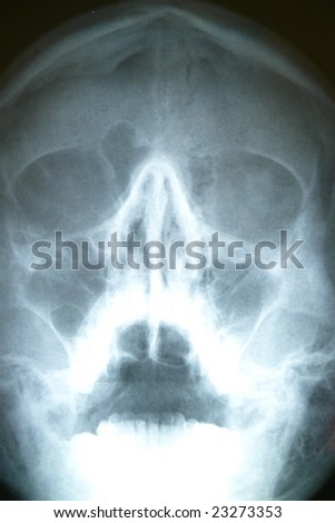human skull front. stock photo : Front of human skull