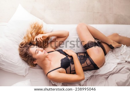 sensual woman in black underwear with a story behind the scratch on her hip