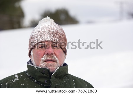 A man wearing a beanie cap and covered with snow is looking at the camera with an unhappy expression. Horizontal shot.
