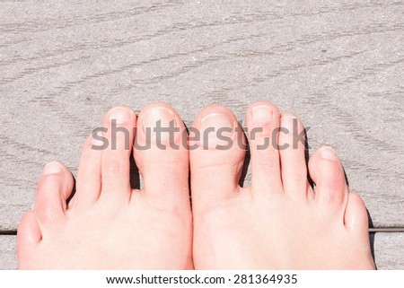 closeup of ugly woman\'s feet on a deck
