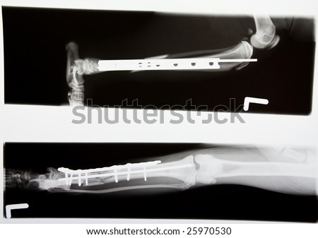 x-ray of a cat\'s broken leg after surgery