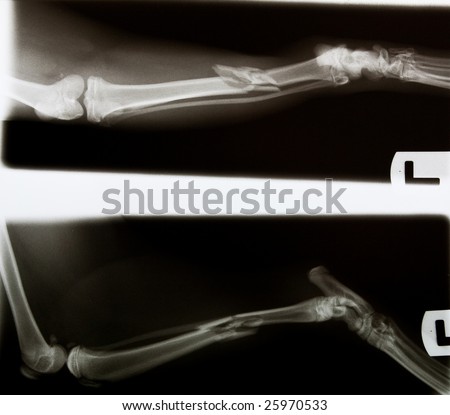x-ray of a cat\'s broken leg before surgery