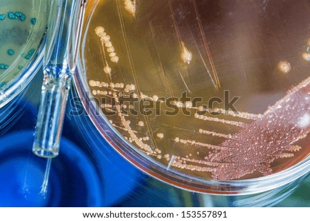 Test tube next to petri dish in laboratory