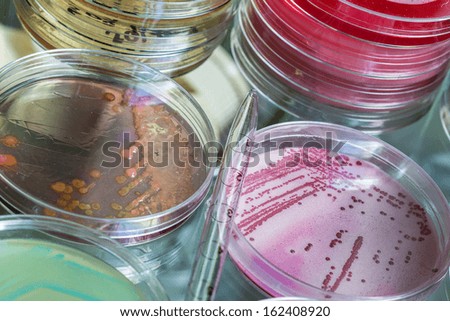 Petri dish full of pink and red micro bacterias