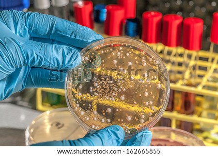 Genetically modified fungi on agar plate in laboratory