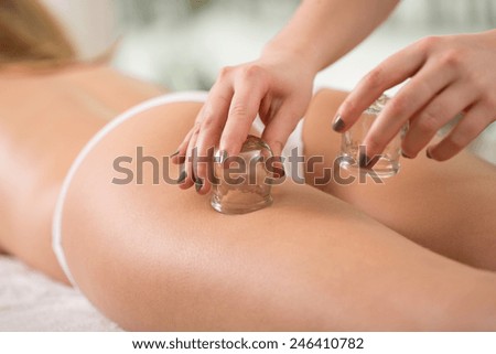 Close-up of young woman\'s anti-cellulite cupping therapy