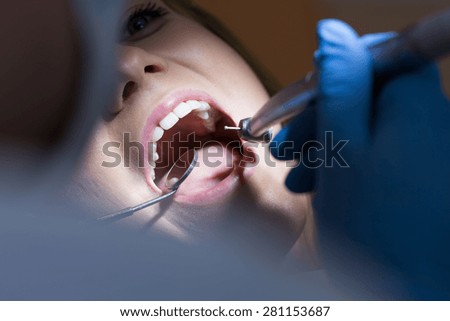 Close-up of young woman\'s open mouth during dental intervention