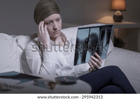 Worried young cancer woman looking at her xray photo