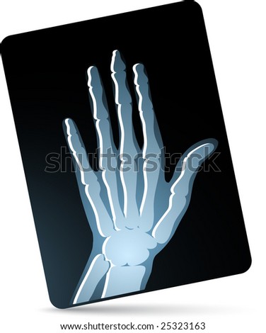 x ray hand. stock vector : x-ray of hand