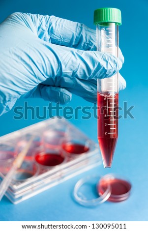 Biochemistry of blood tests. Cell culture for the biomedical diagnostic. Gloved hand hold the tube with blood analysis on blue background. Plastic labware for scientific research.