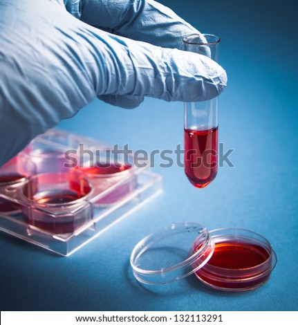 Biochemistry of blood tests. Cell culture for the biomedical diagnostic. Gloved hand hold the pipette with petri dish for blood analysis. Plastic labware for scientific research.