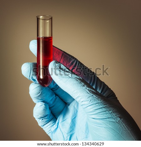 Biochemistry of blood tests. Biochemistry of blood tests. Cell culture for the biomedical diagnostic. Gloved hand hold the tube with blood analysis.