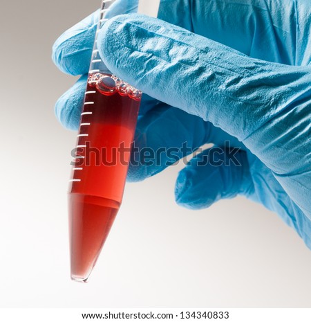 Biochemistry of blood tests. Cell culture for the biomedical diagnostic. Gloved hand hold the tube with blood analysis.