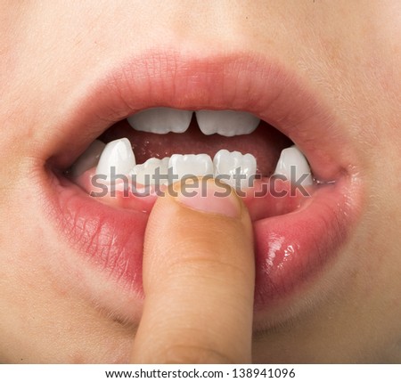 Child shows tooth. Close up studio shot.
