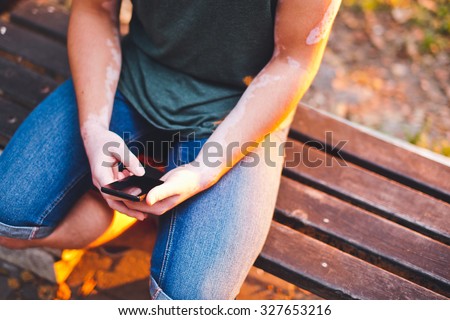 Young happy male with vitiligo relaxing in park at sunset using smartphone for internet. Sits on a bench in park. Chatting with friends through social networks. Black screen. No face. Copy space