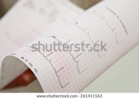 heart beat line diagram
