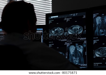 Doctor silhouette looking at  MRI/ MRA (Magnetic Resonance Angiogram) of the human body at a computer in medical institution (doctors office)