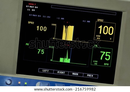 Display Patient Data of Vital Signs Monitor.