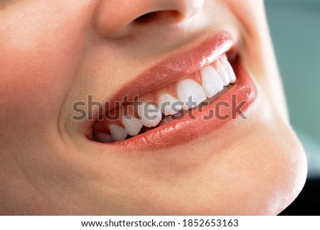 A closeup shot of a smiling woman showing her clean set of teeth and gums