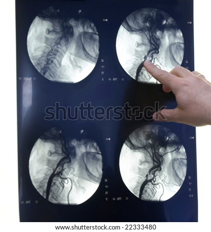 brain x-ray in a x-ray lab exposed