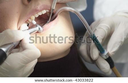 close up of open mouth during dentist checkup