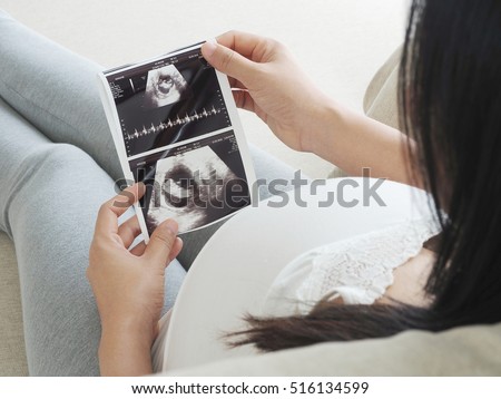 Pregnant woman holding ultrasound scan. Concept of Pregnancy health care.