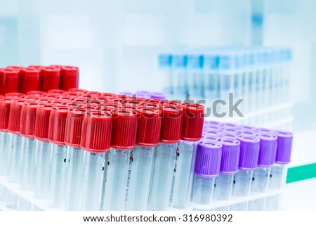 Test tubes in laboratory for  science, scientific, chemical, chemistry research or experiment. Lab medical glass equipment, medicine, biology or biotechnology liquid. Analysis pharmaceutical glassware