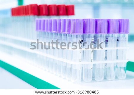 Test tubes in laboratory for  science, scientific, chemical, chemistry research or experiment. Lab medical glass equipment, medicine, biology or biotechnology liquid. Analysis pharmaceutical glassware